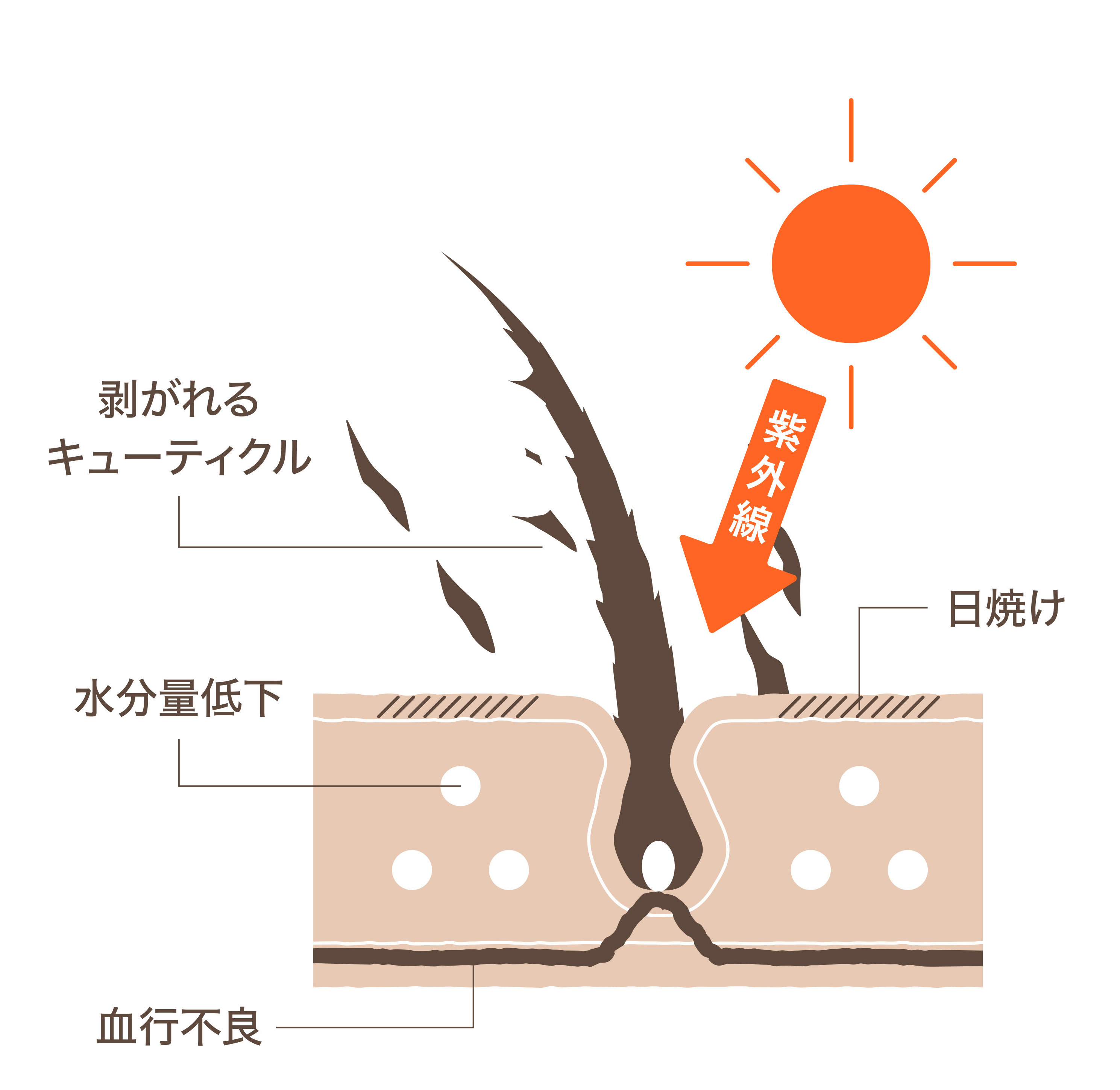 夏のダメージで、剥がれるキューティクル・水分量低下・日焼け・血行不良が起きている髪と頭皮の図