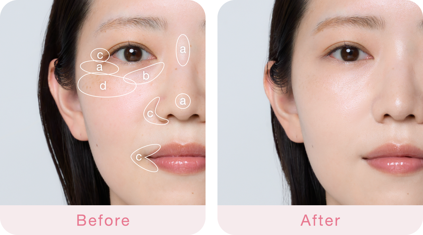 Before After