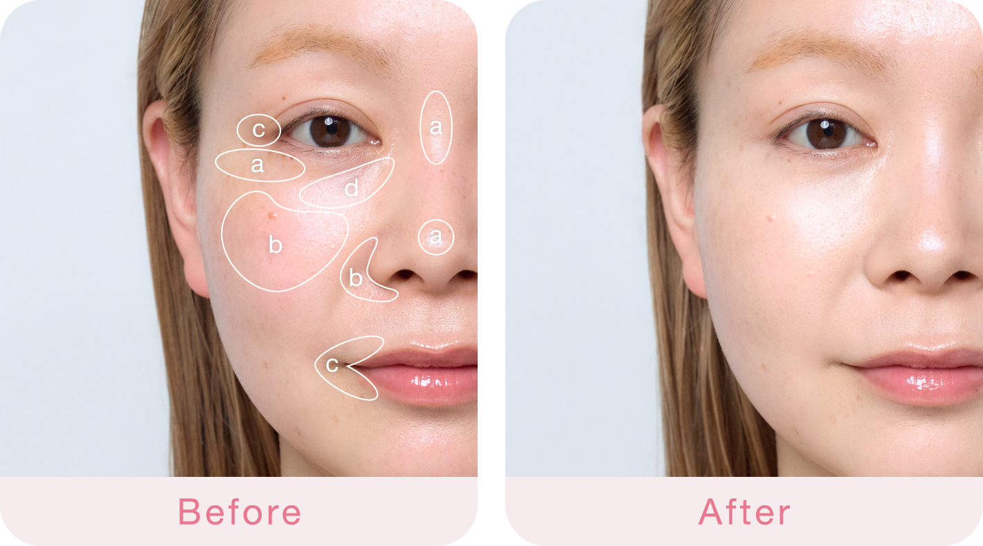 Before After
